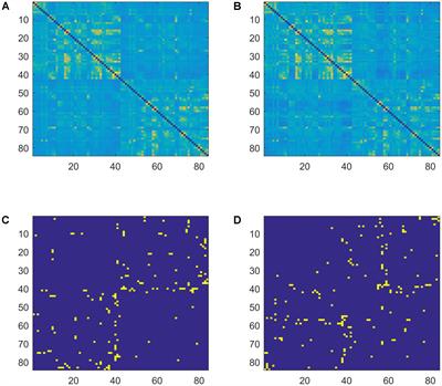 Evidence for a Resting State Network Abnormality in Adults Who Stutter